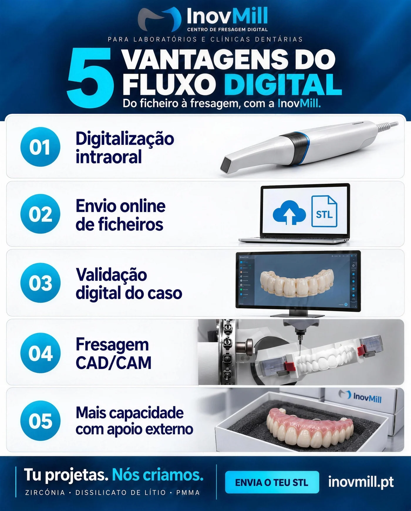 5 vantagens do fluxo digital InovMill: digitalização intraoral, envio online de ficheiros STL, validação digital do caso, fresagem CAD/CAM e mais capacidade com apoio externo