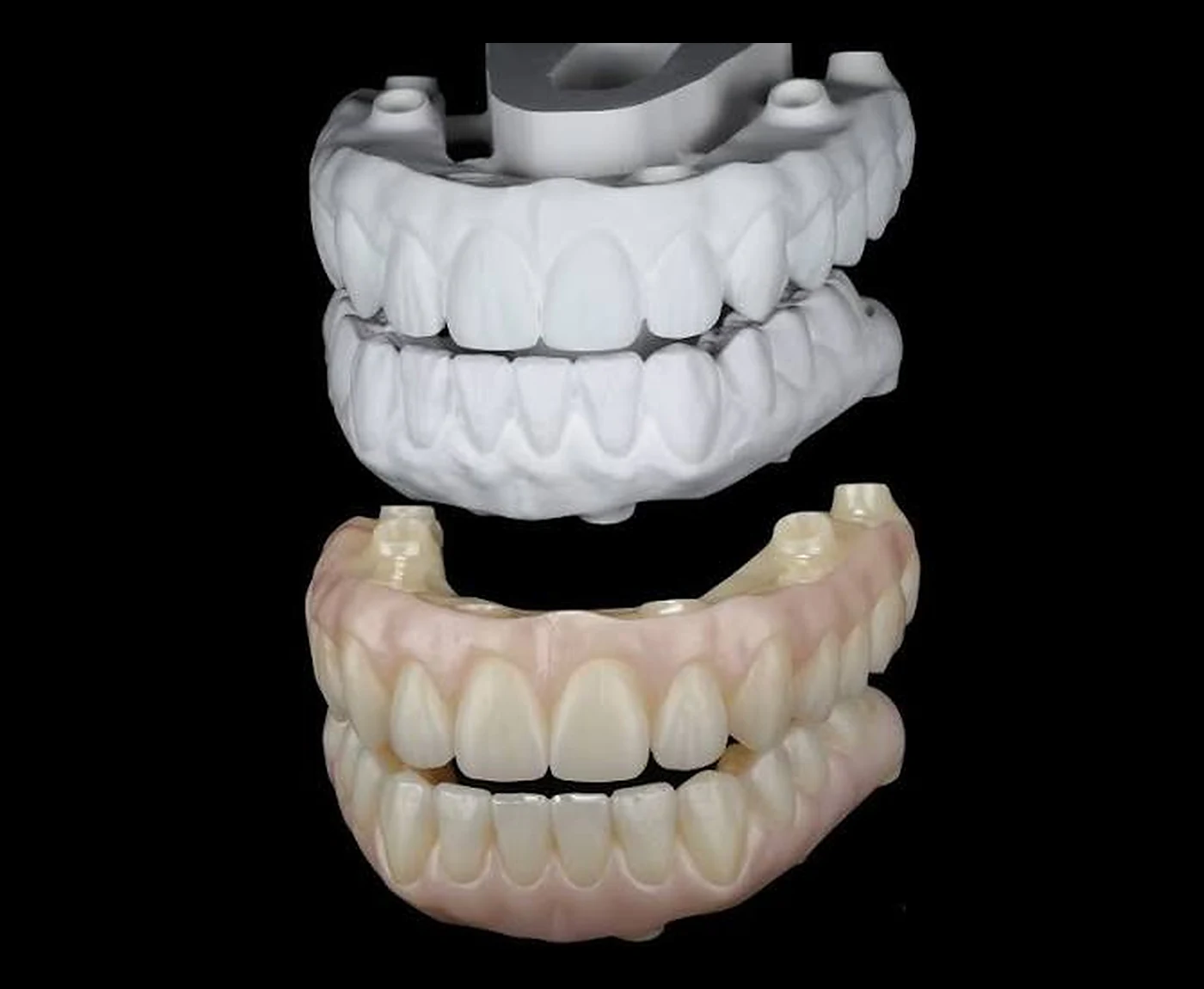 Do modelo em PMMA à reabilitação final — fluxo digital InovMill